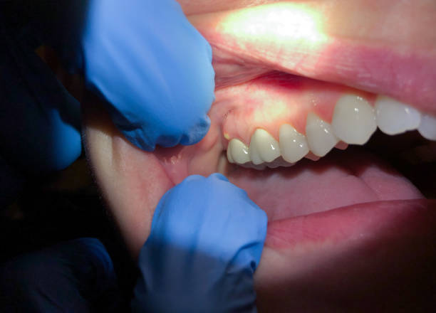 Best Teeth Whitening  in Shadow Lake, WA